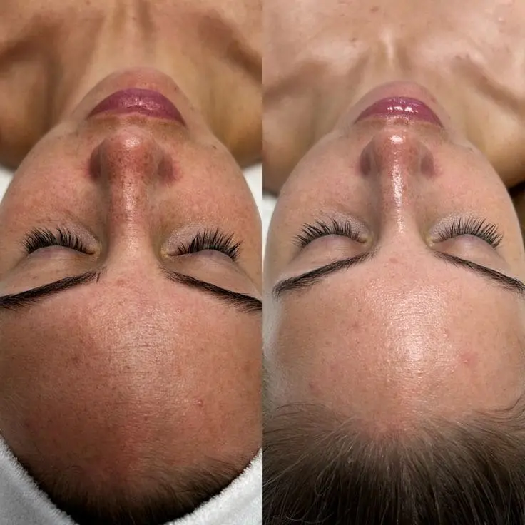 Protocolo de estética regenerativa en consultorio